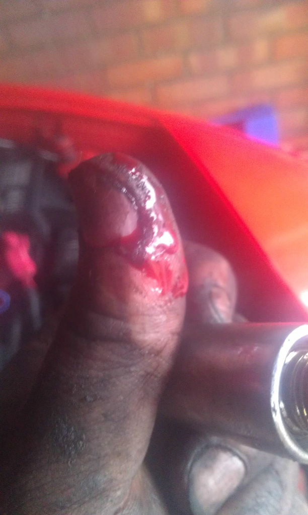 Not happy with just cutting my finger, so I bash my thumb while trying to removed the spark plugs. Got a few spots of blood on the valley cover.